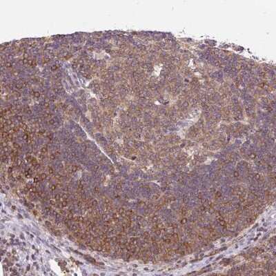Immunohistochemistry: CARD11/CARMA1 Antibody [NBP2-49067]