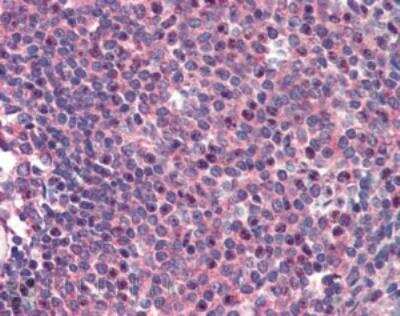 Immunohistochemistry-Paraffin: CARD11/CARMA1 Antibody [NB100-1200]