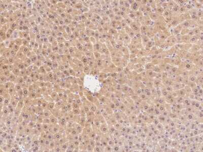 Immunohistochemistry-Paraffin: CARD11/CARMA1 Antibody [NBP2-99265]