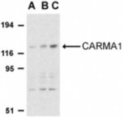 Western Blot: CARD11/CARMA1 AntibodyBSA Free [NBP1-77219]