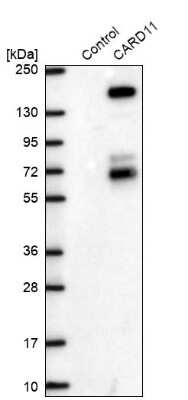 Western Blot: CARD11/CARMA1 Antibody [NBP2-49067]