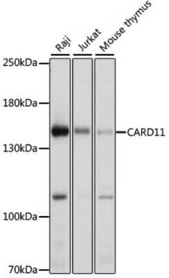 Western Blot: CARD11/CARMA1 AntibodyBSA Free [NBP2-92910]