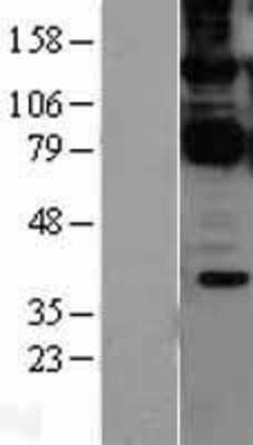 Western Blot: CARD11/CARMA1 Overexpression Lysate [NBL1-08695]