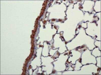 Immunohistochemistry: CARD12 Antibody - BSA Free [NBP1-78979]