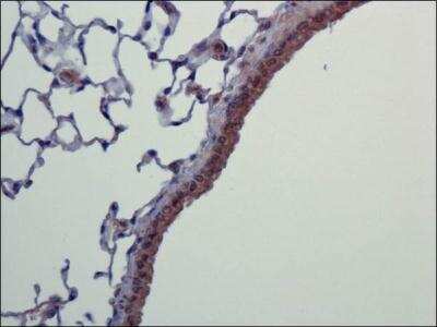 Immunohistochemistry: CARD12 Antibody - BSA Free [NBP1-78980]