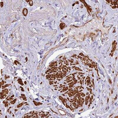 Immunohistochemistry: CARD12 Antibody [NBP2-13660]