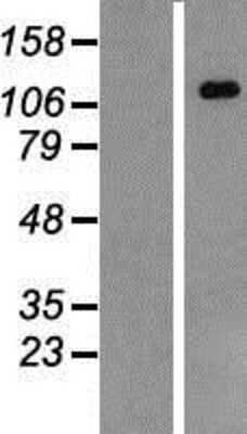 Western Blot: CARD12 Overexpression Lysate [NBP2-06545]