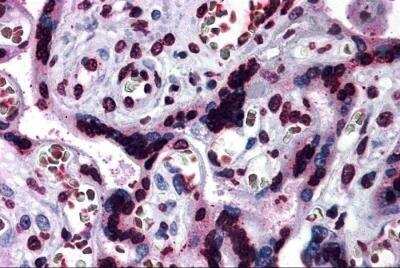 Immunohistochemistry-Paraffin: CARD14 Antibody - BSA Free [NBP2-81901]