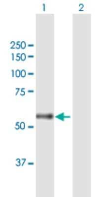 Western Blot: CARD14 Antibody [H00079092-B01P]