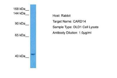 Western Blot: CARD14 Antibody [NBP2-86472]