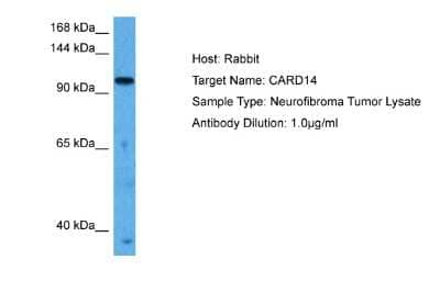 Western Blot: CARD14 Antibody [NBP2-86596]