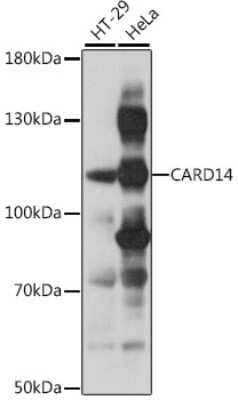 Western Blot: CARD14 AntibodyAzide and BSA Free [NBP2-92873]