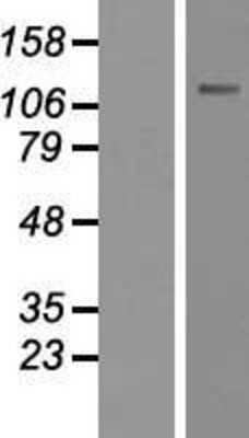 Western Blot: CARD14 Overexpression Lysate [NBP2-06347]