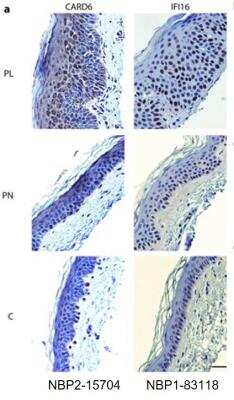 Immunohistochemistry: CARD6 Antibody [NBP2-15704]