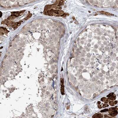 Immunohistochemistry-Paraffin: CARD6 Antibody [NBP1-85613]