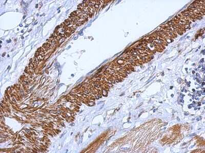 Immunohistochemistry-Paraffin: CARD6 Antibody [NBP2-15704]