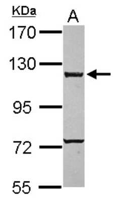 Western Blot: CARD6 Antibody [NBP2-15704]