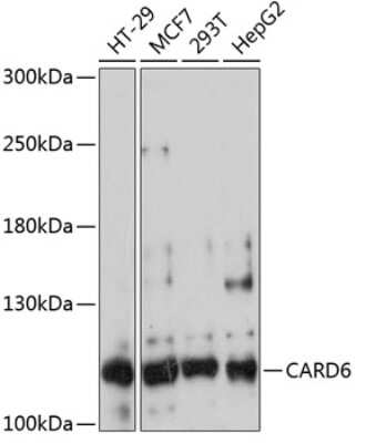 Western Blot: CARD6 AntibodyAzide and BSA Free [NBP2-92129]