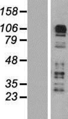 Western Blot: CARD6 Overexpression Lysate [NBP2-05992]