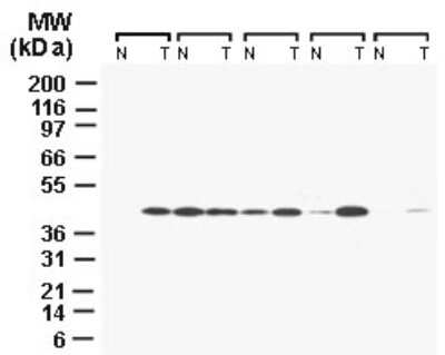 Western Blot: CARD8 Antibody [NB100-56182]