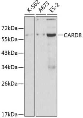 Western Blot: CARD8 AntibodyBSA Free [NBP2-91989]