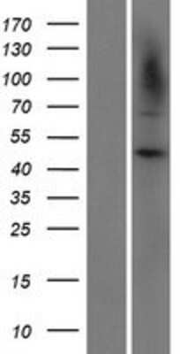 Western Blot: CARD8 Overexpression Lysate [NBP2-10259]