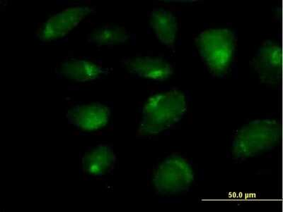 Immunocytochemistry/ Immunofluorescence: CARD9 Antibody [H00064170-B01P]