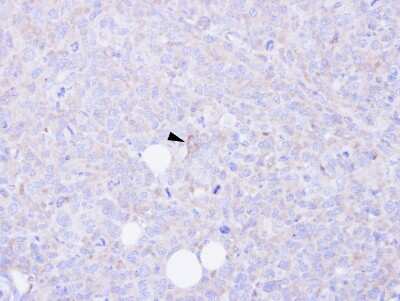 Immunohistochemistry-Paraffin: CARD9 Antibody [NBP1-32982]