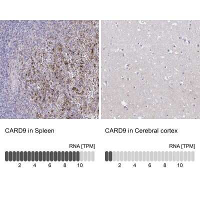 Immunohistochemistry-Paraffin: CARD9 Antibody [NBP2-37975]