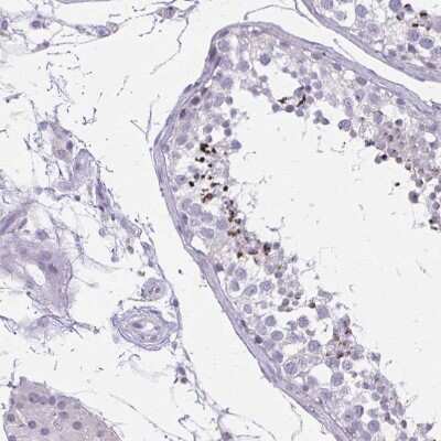 Immunohistochemistry-Paraffin: CARD9 Antibody [NBP2-37975]