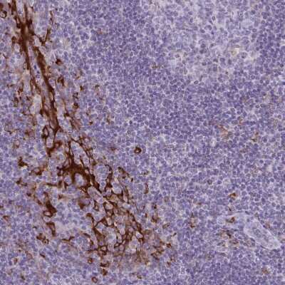 Immunohistochemistry-Paraffin: CARD9 Antibody [NBP2-37975]
