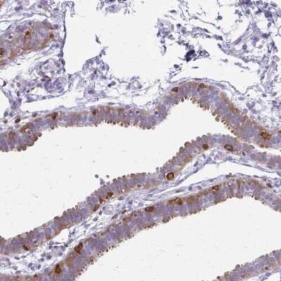 Immunohistochemistry-Paraffin: CARD9 Antibody [NBP2-37975]
