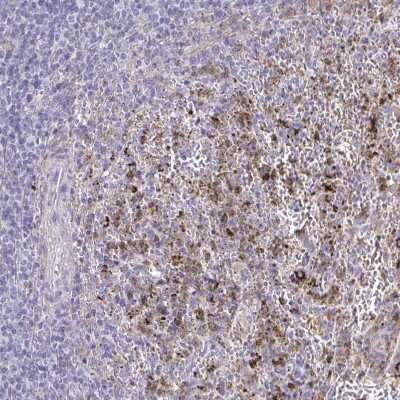 Immunohistochemistry-Paraffin: CARD9 Antibody [NBP2-37975]