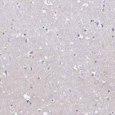 Immunohistochemistry-Paraffin: CARD9 Antibody [NBP2-37975]