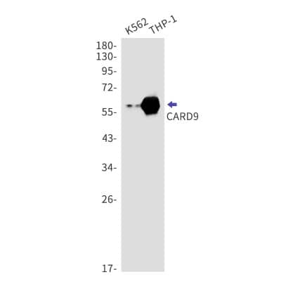 Western Blot: CARD9 Antibody (S02-7H5) [NBP3-19592]