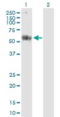 Western Blot: CARD9 Antibody [H00064170-B01P]