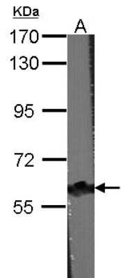 Western Blot: CARD9 Antibody [NBP1-32982]