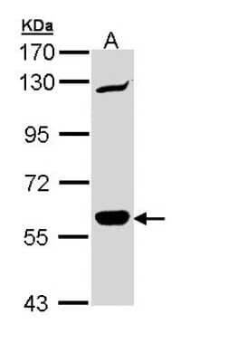 Western Blot: CARD9 Antibody [NBP1-32982]