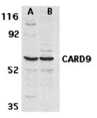 Western Blot: CARD9 AntibodyBSA Free [NBP1-76679]