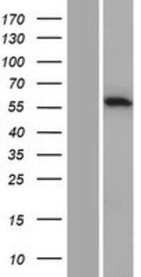 Western Blot: CARD9 Overexpression Lysate [NBP2-05865]