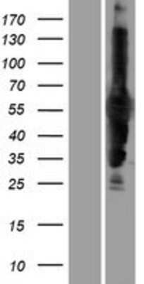 Western Blot: CARD9 Overexpression Lysate [NBP2-09950]