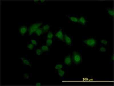 Immunocytochemistry/ Immunofluorescence: CARF/CDKN2AIP Antibody (1A6) [H00055602-M02]