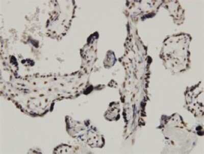 Immunohistochemistry-Paraffin: CARF/CDKN2AIP Antibody (1A6) [H00055602-M02]