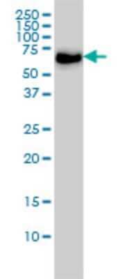 Western Blot: CARF/CDKN2AIP Antibody (1A6) [H00055602-M02]