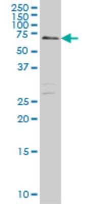 Western Blot: CARF/CDKN2AIP Antibody (1E10) [H00055602-M03]