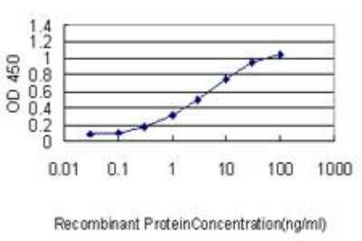 ELISA: CARF/CDKN2AIP Antibody (1F7) [H00055602-M06]