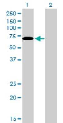 Western Blot: CARF/CDKN2AIP Antibody (1F7) [H00055602-M06]