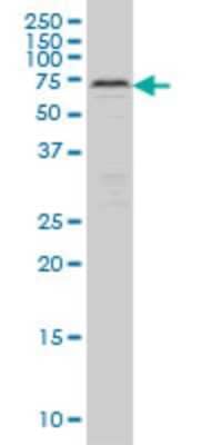 Western Blot: CARF/CDKN2AIP Antibody (2E6) [H00055602-M04]