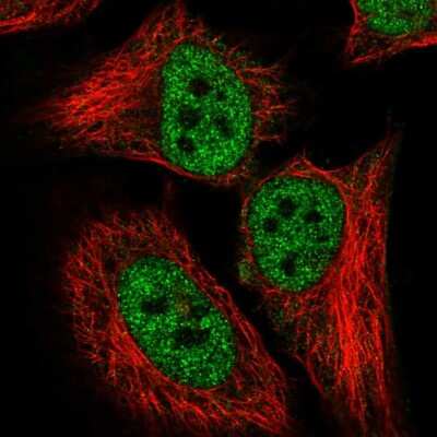 Immunocytochemistry/ Immunofluorescence: CARF/CDKN2AIP Antibody [NBP2-55694]