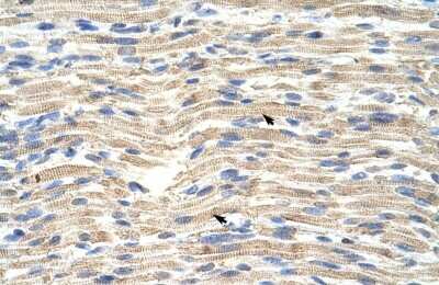 Immunohistochemistry-Paraffin: CARF/CDKN2AIP Antibody [NBP1-57236]